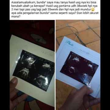 Berbagi pengalaman