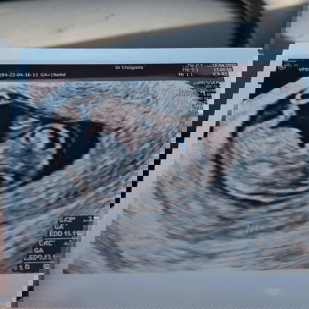 มีคำถามจะมาถามแม่ๆทุกคนหน่อยค่ะ 🥰🥰