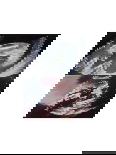 Confius gender baby??