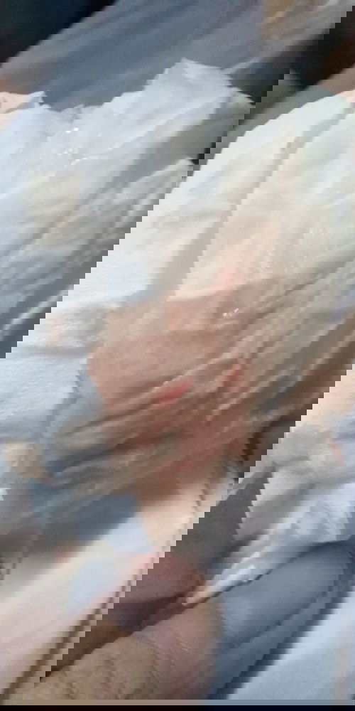 ตั้งครรภ์​ 5 สัปดาห์​