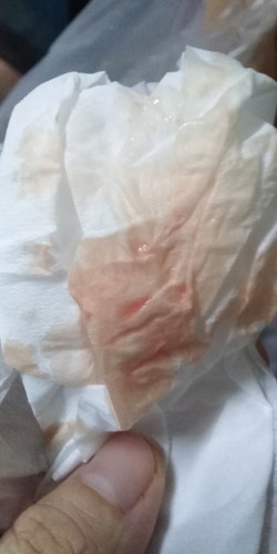 ตั้งครรภ์ 5 สัปดาห์