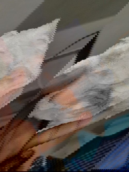 keluar flek inu diusia hamil 7w