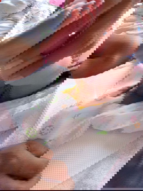 ถ่ายแบบนี้เรียกว่าท้องเสียไหมคะ พอดีแม่ถามคนที่บ้านคนที่บ้านบอกปกติค่ะ น้องกินนมผงสลับกับแม่อึบ่อย