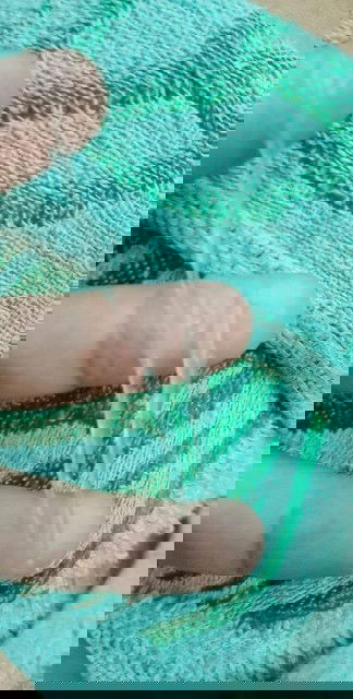 ขอถามแม่ๆ​ วันนี้พึ่งมีมูกใสไหลออกมาไม่มากเท่าที่ในรูป​ หมายถึงอะไรหรอคะ? ต้องไปหาหมอเลยไหมคะ?