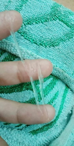 ขอถามแม่ๆ วันนี้พึ่งมีมูกใสไหลออกมาไม่มากเท่าที่ในรูป หมายถึงอะไรหรอคะ? ต้องไปหาหมอเลยไหมคะ?