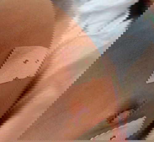 สะดือน้องเป็นแบบนี้