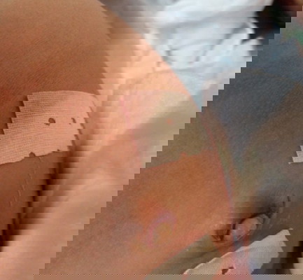 สะดือน้องเป็นแบบนี้