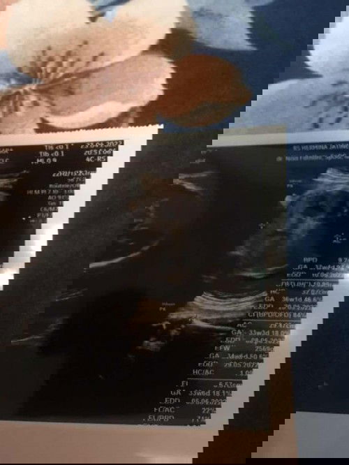 Bpd lebih besar dr usia kehamilan