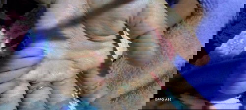 Mata baby newborn belekan