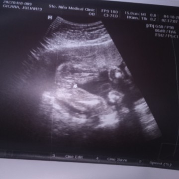 BOY OR GIRL?