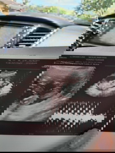 tingin nyo po anu gender ng baby ko? my makasagot sana.