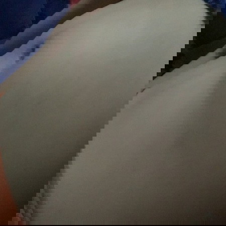 สอบถามมีเเม่ๆคนไหนเป็นบ้างค่ะ