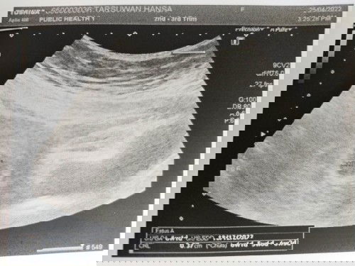 ฝากครรภ์6w1d