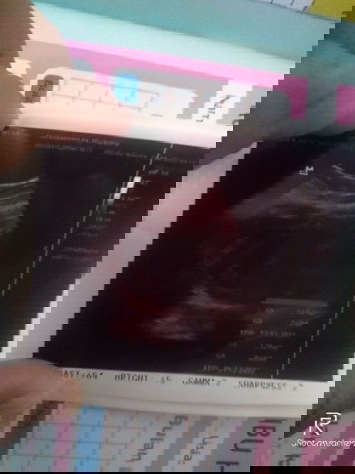 panggul sakit dan panas ,sakit perut bawah