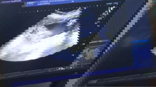 แม่ๆว่าผู้หญิงหรือผู้ชายค่ะ 🥰🥰🥰🥰
ป้าหมอบอกน้องมีกลีบบ