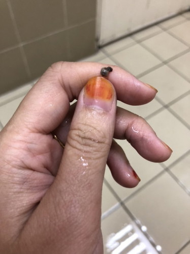 Hamil 6minggu