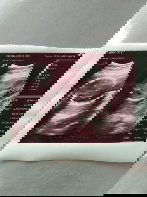 Bingung dengan perhitungan usia kandungan