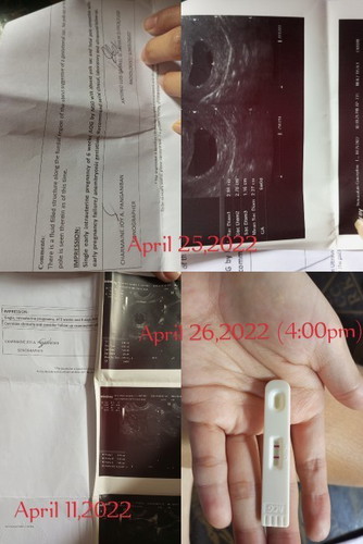 PLEASE HELP ! FALSE PREGNANCY DAW PERO BUT POSITIVE ANG PT KO AFTER TRANSV ?