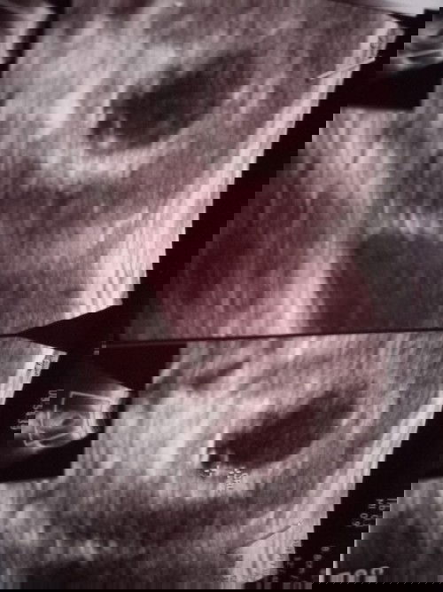 Kehamilan 6 week ada flek coklat..