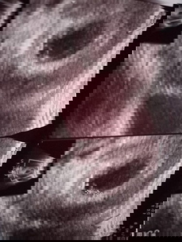 Kehamilan 6 week ada flek coklat..