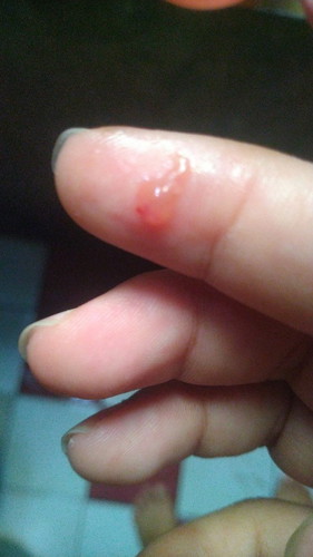 Kalo Anyang anyangan harus apa ya Bun?