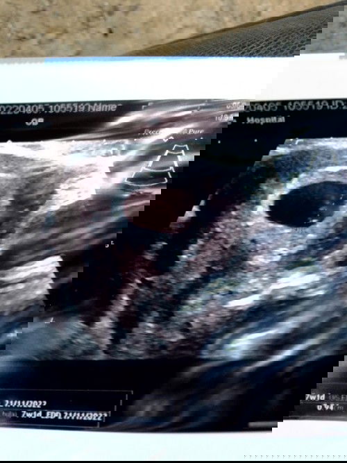 ครรถที่2ค่ะ