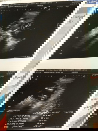 ผช. ผญ. คะ