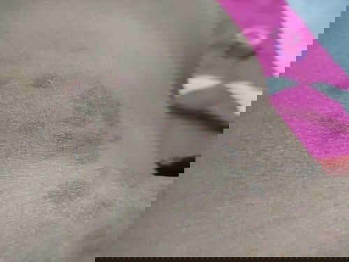 Tentang gatall kulit