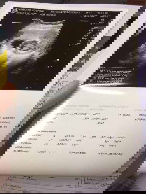 ชวนคุณแม่มาอวดภาพอัตราซาวด์ครั้งแรกกันจ้า❤️❤️