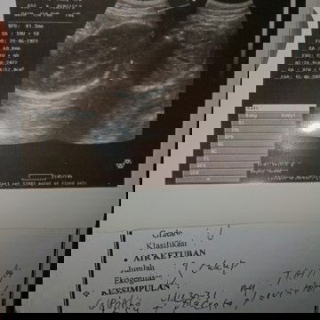 HPL mundur Jauh banget