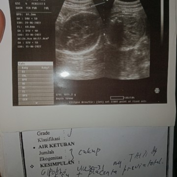 HPL mundur Jauh banget