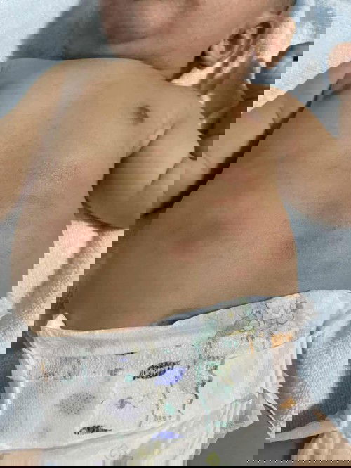 hi mamy2.. badan anak saya bintik2 merah mcm ni laa sape tahu ni kenapa ye.. alahan susu ke ekzema ke ?