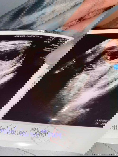 9 วีคไม่เจอตัวเด็ก 🥺