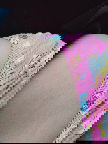 Ano po gamot sa rashes ng buntis?