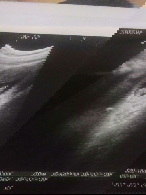 Bund minta saran. Sebaiknya saya ke bidan lagi utk memastikan atau tidak?