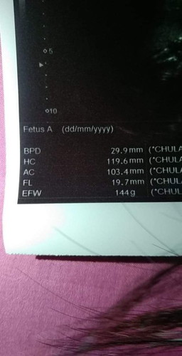 ช่วยดูผลอัลตร้าซาวด์ให้หน่อยค่ะ🙏