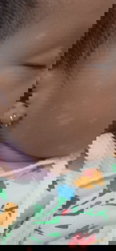 Gimana ya bun cara ngilangin bercak putih kayak panu seperti ini???