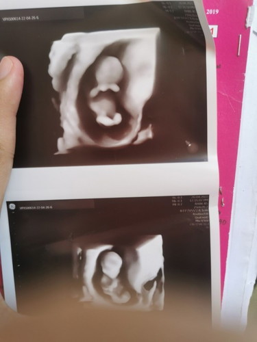 11weeks2days