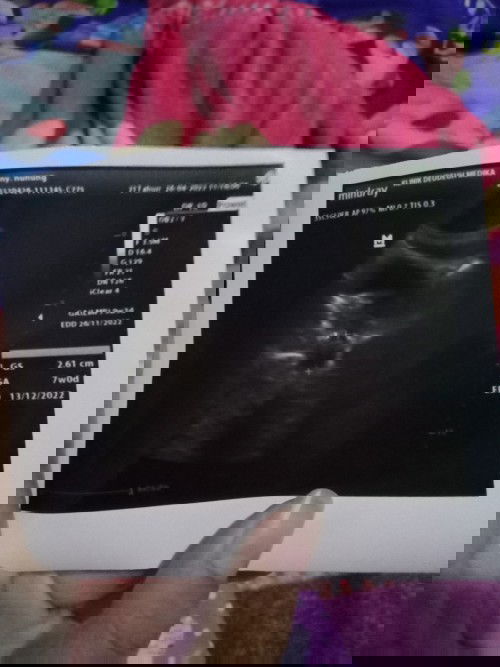 Mff jangan di buli yah🥰