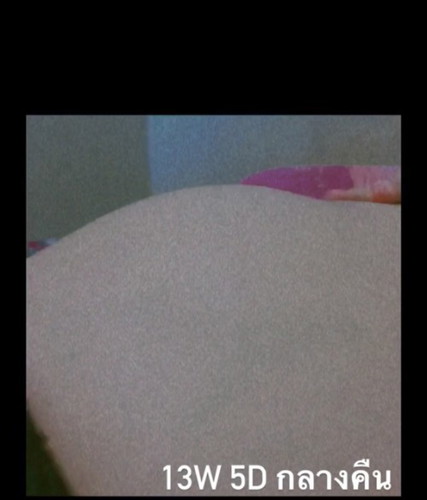 แบบนี้ท้องเล็กเกินไปมั้ยคะ 13w 5d