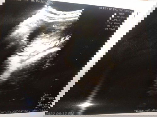 Mau tnya ini cara baca usgnya gmna ya, dan uda hamil brpa minggu, krna gk smpt tanya dokter kmren🙏