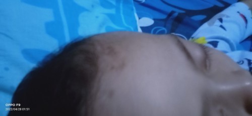 Bun,anak saya terbentur di kepala nya ada sedikit cedera, ters sya pank soalny ank sya bru 8 bulan.