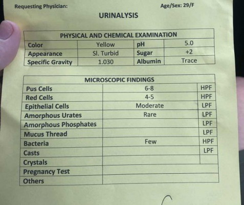 +2 sugar Urinalysis Result