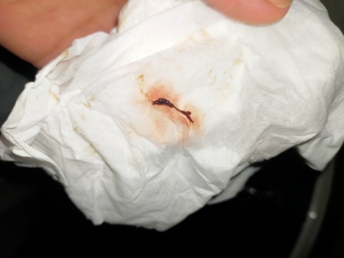 ท้อง17สัปดาห์