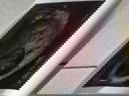 Usia kehamilan 10 week,sdh ada janin tapi belum terdengar djj