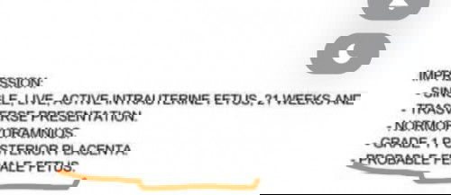 Baby Gender Confirmation