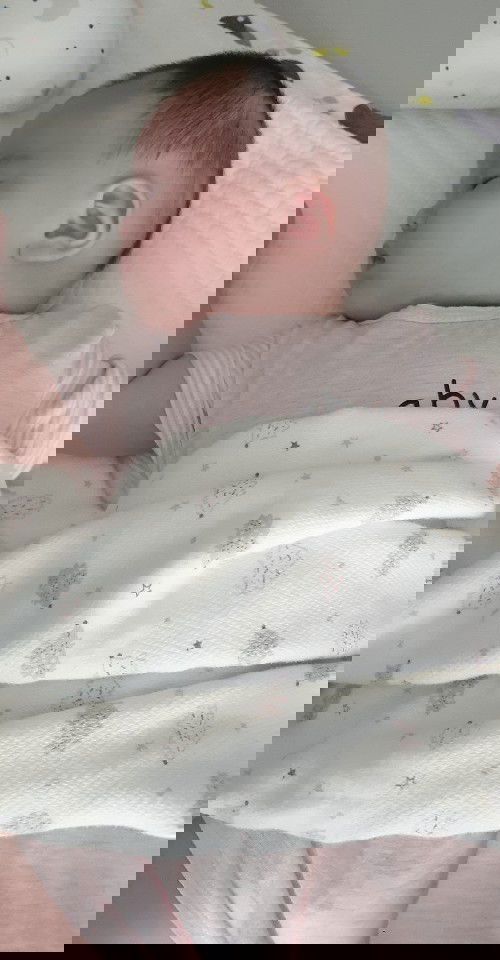 ทารกคอเอียง