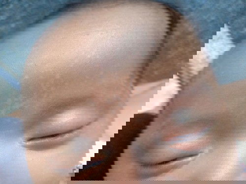 Bercak putih di dahi dan alis