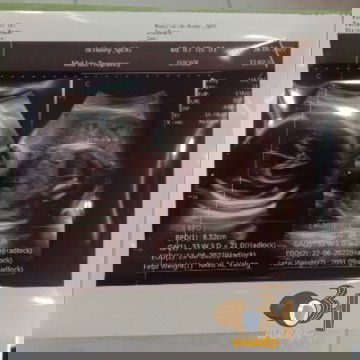 Perubahan Jenis kelamin