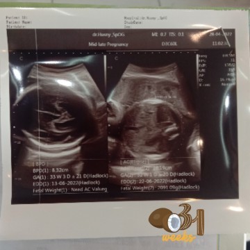 Perubahan Jenis kelamin